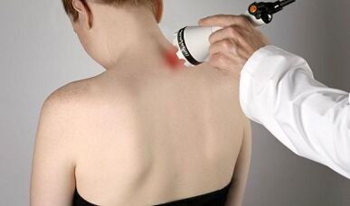 Mina tratatzea lepoan prozedura fisioterapeutikoak