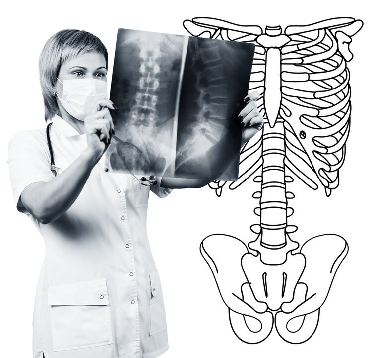 Lumbar bizkarrezurraren erradiografia