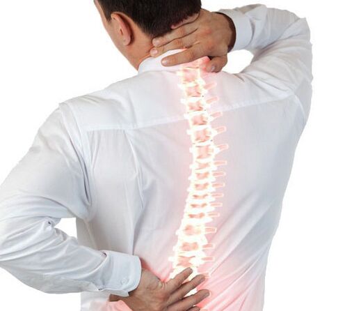 bizkarrezurreko osteokondrosia gizon batean